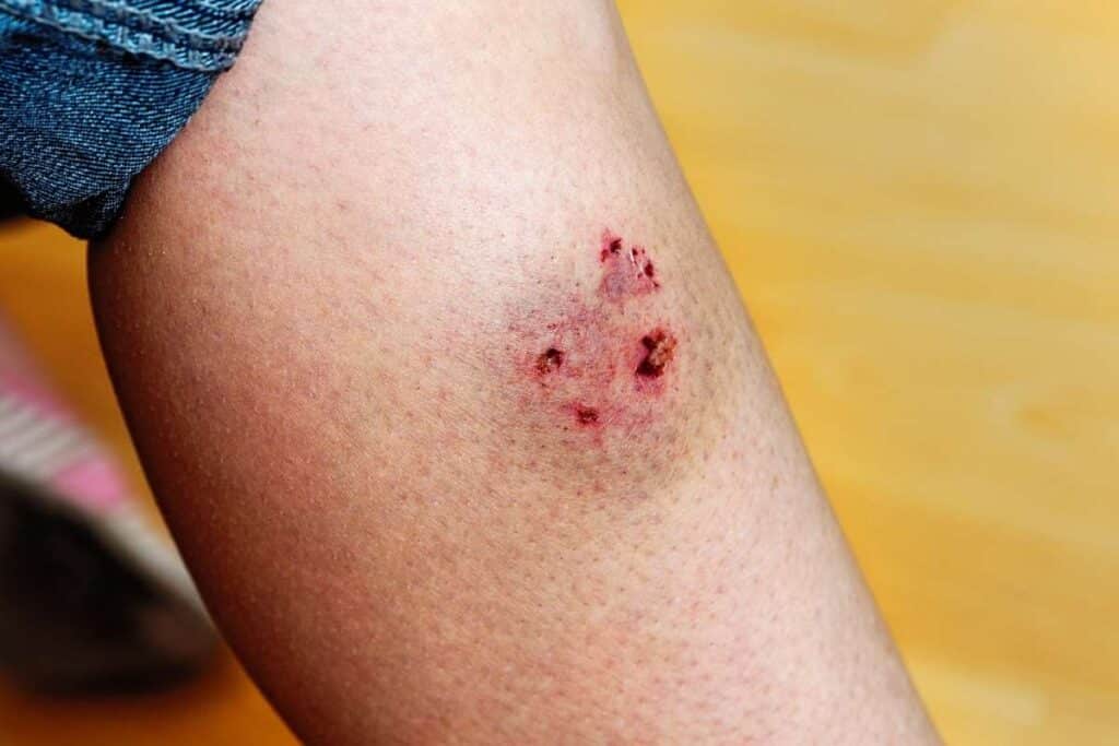 Dog Bite Attorneys in Portland, OR